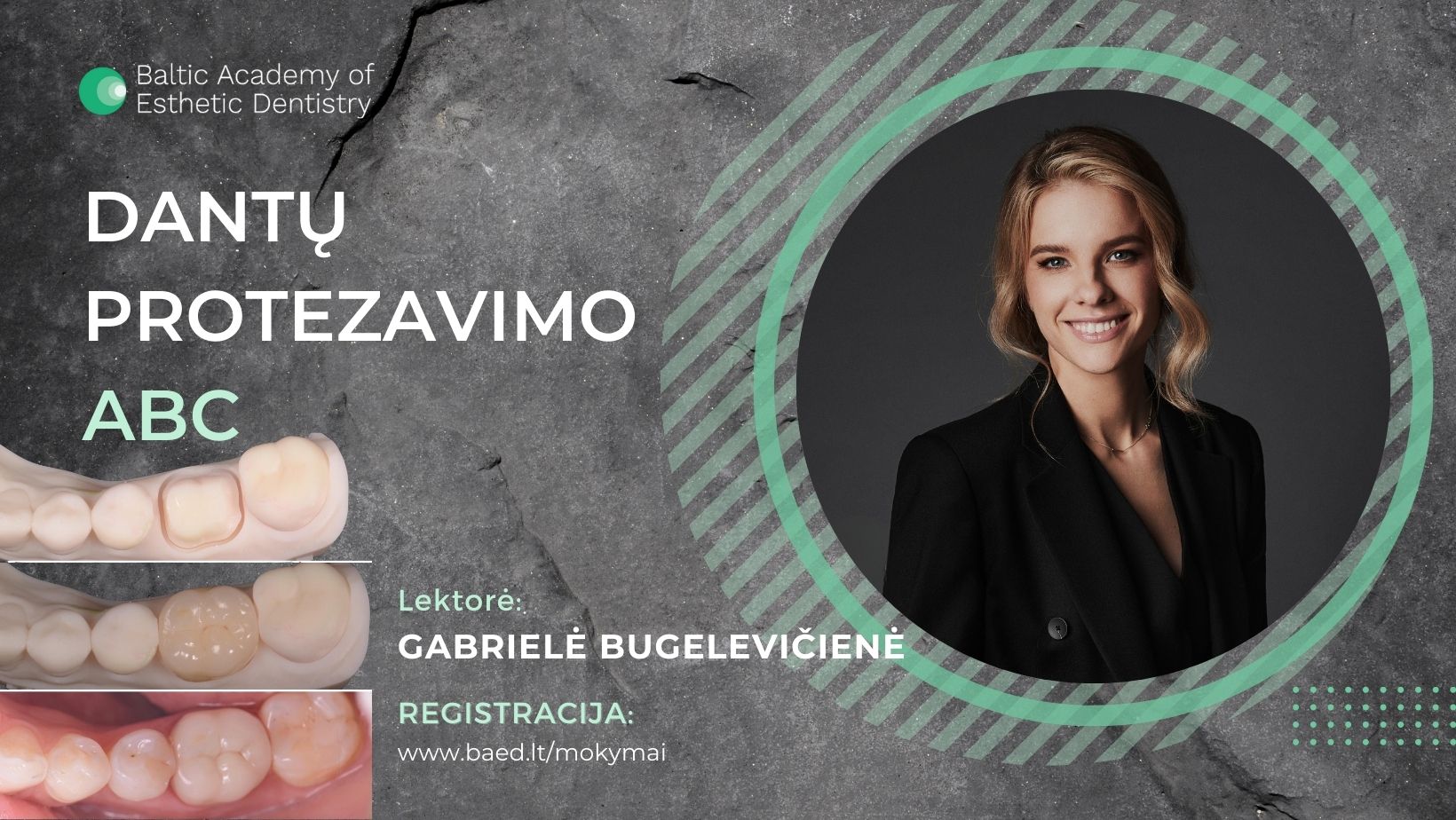 Gabrielė Bugelevičienė. Protezavimo ABC